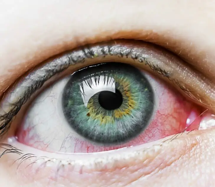 What to Do if You Get Jalapeño Pepper in Your Eyes The Spicy Trio